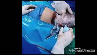 KUMPULAN VIDEO IBU MELAHIRKAN NOSENSOR (REAL VIDEO)