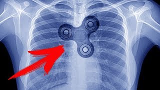 5 НЕРЕАЛЬНЫХ ФОКУСОВ СО СПИННЕРАМИ + ОБУЧЕНИЕ | КАК СДЕЛАТЬ СПИННЕР СВОИМИ РУКАМИ