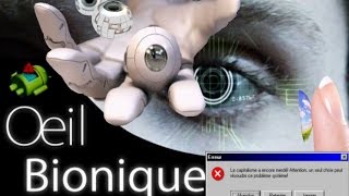 La réalité a dépasser la fiction : L' oeil bionique ( Transhumanisme )
