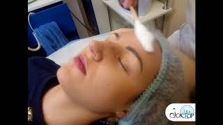 Криомассаж в Киеве Доктор ЛИО косметолог
