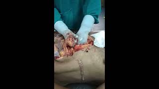 Live postmortem examination from GMC mortuary