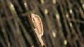Lice-Mayo Clinic