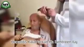 Hepatitis c virus remove desi methods