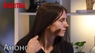 Ее лицо будто кадр из фильма ужасов – Я стесняюсь своего тела. Анонс. Смотрите 21.04.16
