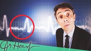 Vorhofflimmern - was ist das? | Dr. Heart