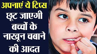 बच्चों को है नाखून चबाने की आदत तो अपनाएं ये टिप्स | Tips to stop kids from Nail Biting | Boldsky