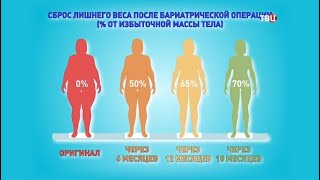 Кому показана бариатрия. Доктор И...