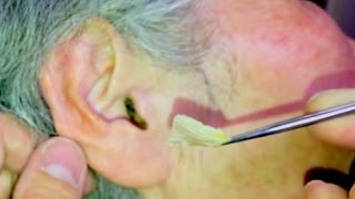 巨大耳あかHuge dry earwax kotoran telinga 귀지 ที่แคะหู cerumen 耳垢 ушная сера