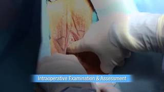 vaginal tightening cream
