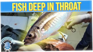 Fisherman Has Live Fish Stuck in His Throat in Bizarre Accident (ft. Big Boy)