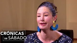Natalia Ponce de León recuerda lo que sintió al ser atacada con ácido sulfúrico