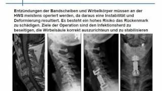 Video HWS Operationen