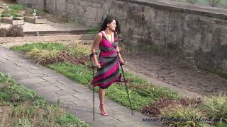 Amputee woman Natalie is on the phone