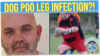 Rugby Player Continues to Suffer After Injury Got Infected by Dog Poo