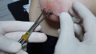 Nipple piercing delimi