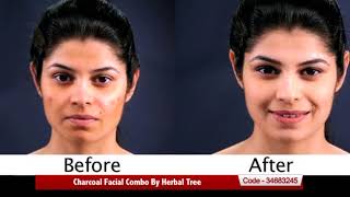 Charcoal Facial Combo By Herbal Tree