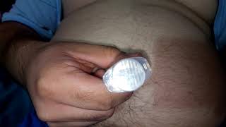 Needle in deep navel