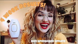 AT HOME LASER HAIR REMOVAL RESULTS AFTER 4 WEEKS | KENZZI IPL RESULTS