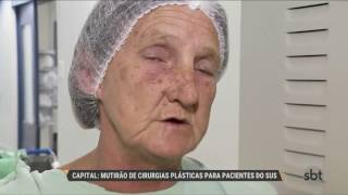 Mutirão de cirurgias plásticas deve se repetir neste ano na Capital