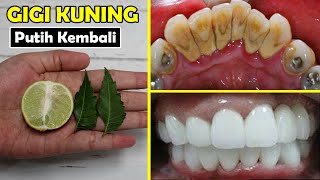 CARA TERMUDAH MEMUTIHKAN GIGI KUNING SECARA ALAMI, HANYA PAKAI DAUN MIMBA 