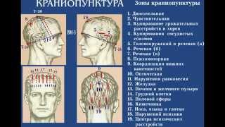 Краниопунктура. Дистанционное обучение иглотерапии (акупунктуре).