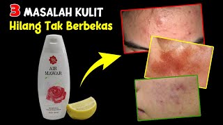 LIBAS 3 MASALAH KULIT WAJAH HANYA DENGAN RAMUAN RUMAHAN INI [SUDAH TERBUKTI] 