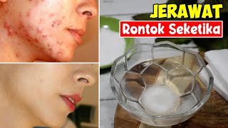 CEPAT BANGET! JERAWAT MEMBANDEL LANGSUNG HILANG, WAJAH PUTIH MULUS SEPERTI KULIT BAYI | SEHAT TUBE