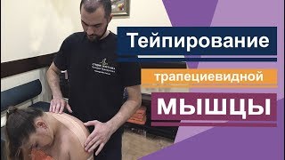 Тейпирование трапециевидной мышцы. Trapezius muscle taping