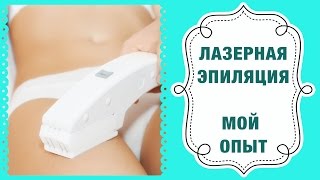 Лазерная эпиляция - мой опыт (ноги, руки, бикини, подмышки, лицо) | Dasha Voice