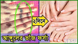 আঙ্গুল ফর্সা: আঙ্গুলের ভাঁজের কালো দাগ দূর করার খুব সহজ ও ১০০%কার্যকর পদ্ধতি/ আঙুল ফর্সা করার উপায়