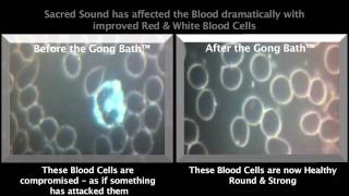 Gong Bath - Blood Testing - Before & After; Part 1 of 2