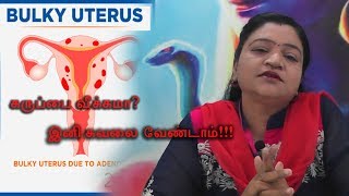 கருப்பை வீக்கம் || Dr Deepa Arulaalan || Thirupathur || jai tv official