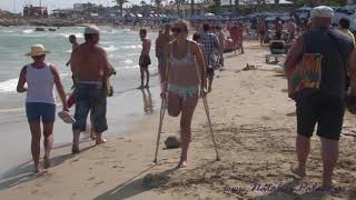 Amputee Carolina is enjoying a day at he beach