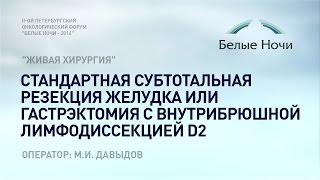 Мастер класс "Живая хирургия": субтотальная резекция желудка или с внутрибрюшной лимфодиссекцией D2