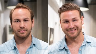 From Baldness to Summer Hairstyle 2018 | Haarersatz Transformation | Hairsystems Heydecke
