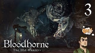 Людвиг, босс1● НЁХ ● Bloodborne: Old Hunters