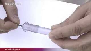 AlaxoLito Nasal Stent
