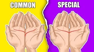 Things Your Palm Reveals About You