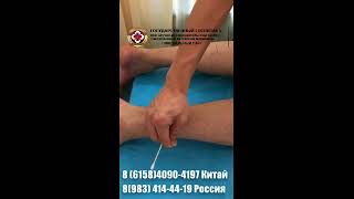 Полиневропатия нижних конечностей лечение в госпитале ТКМ Далянь, Китай