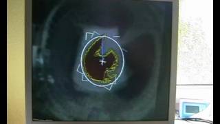 Realtime, high-speed image processing demo