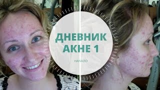 ДНЕВНИК АКНЕ 1. НАЧАЛО