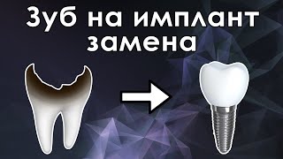 Атравматичное удаление зубов с одномоментной установкой имплантатов