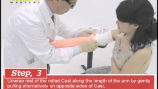 Long Arm Cast Application