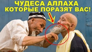 ЧУДЕСА АЛЛАХА КОТОРЫЕ ПОРАЗЯТ ВАС! ПОЛЬЗА БОРОДЫ!