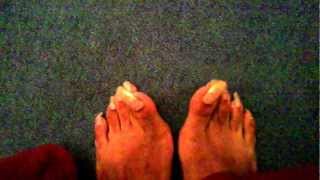 Long toenails