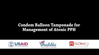 Condom Catheter Temponade - PPH (Dr. Shailja Sinha)