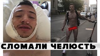 Сломали челюсть на пикап тренинге. Стал неадекватным? РЕАКЦИЯ РОДИТЕЛЕЙ.