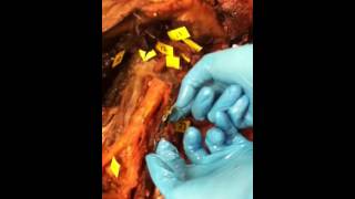 Female Cadaver Anatomy