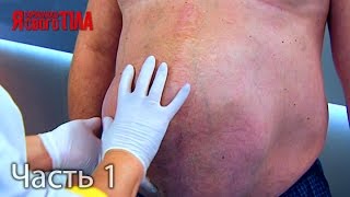 Я стесняюсь своего тела. Сезон 3. Выпуск 13. Часть 1 из 5