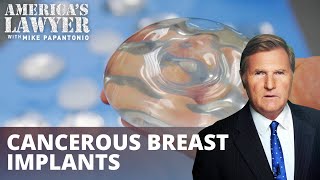 Cancer-Causing Breast Implants Spurring Lawsuits